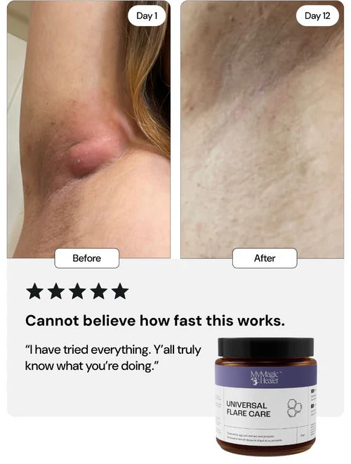 Universal Flare Care