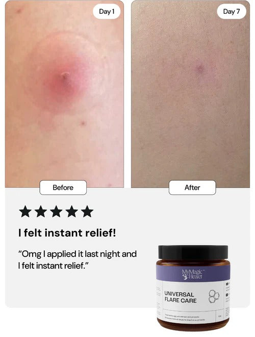 Universal Flare Care